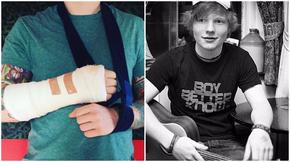 Ed Sheeran injures arm in bicycle accident