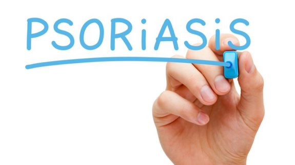 Psoriasis Severity Linked To Higher Risk Of Diabetes - The Statesman