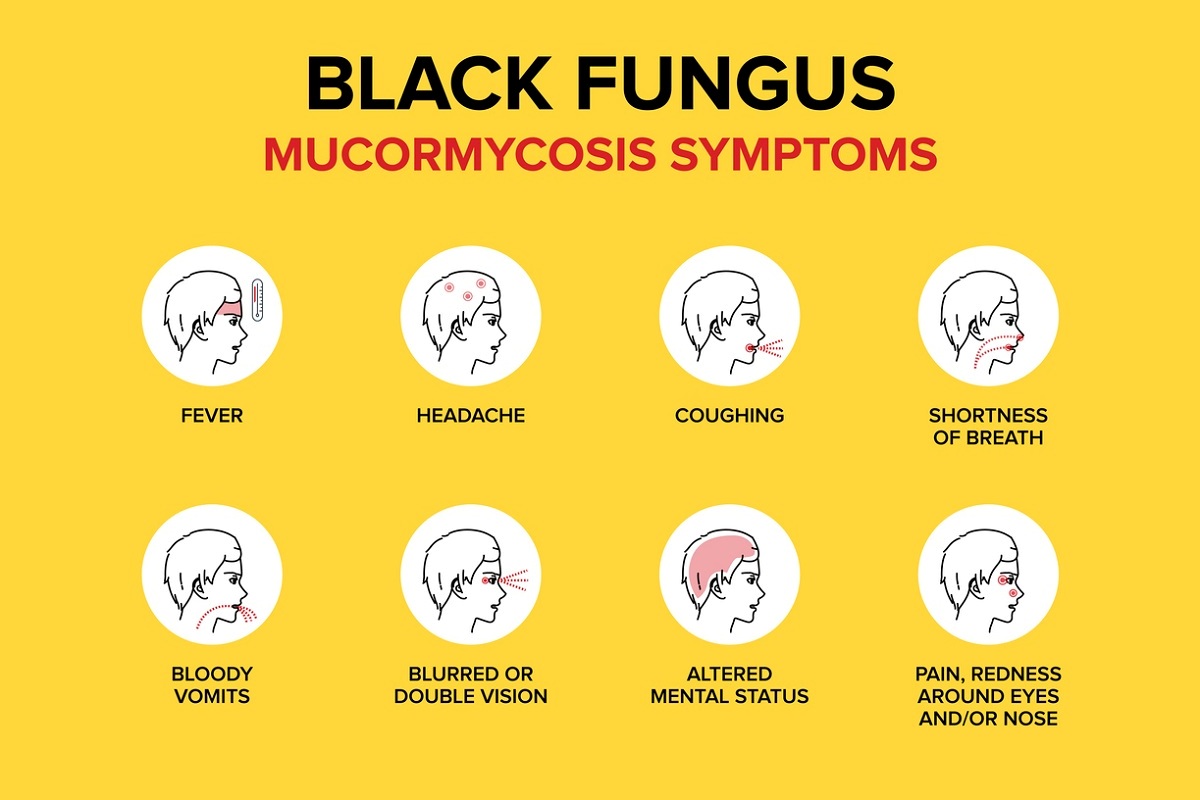 HP Issues Treatment Protocol For Black Fungus Disease The Statesman