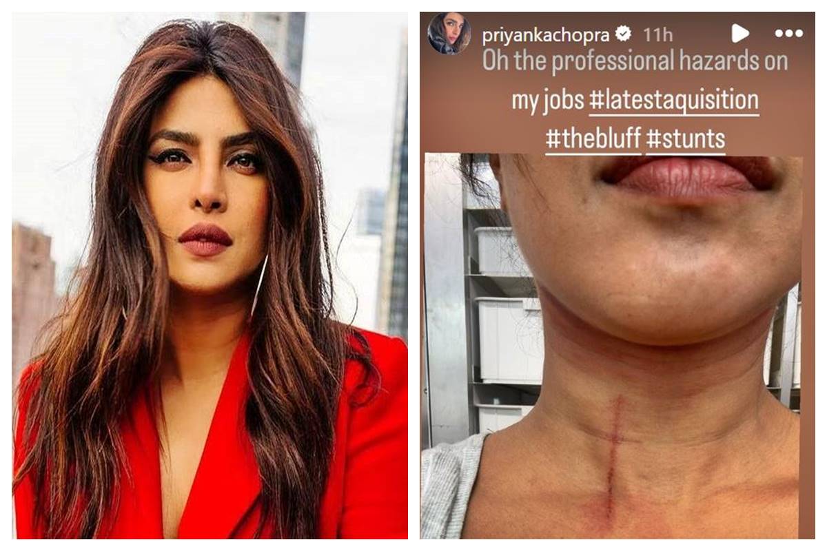 Priyanka Chopra injured on the ‘The Bluff’ set in Australia