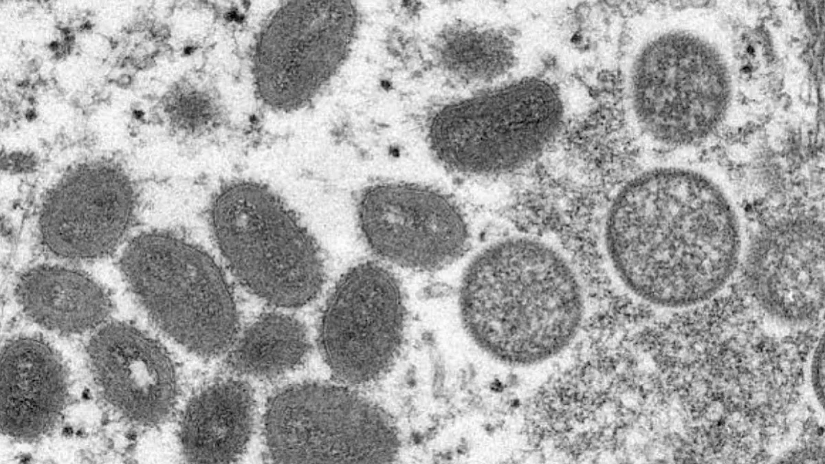 Uganda to start next phase of mpox vaccination with 100,000 additional doses